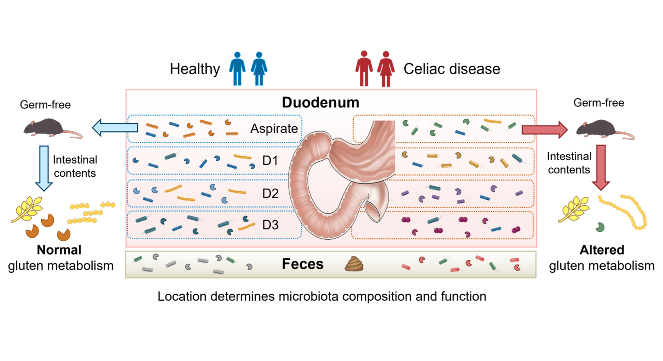 Het microbioom van de kleine darm: een onderbelicht ecosysteem bij coeliakie